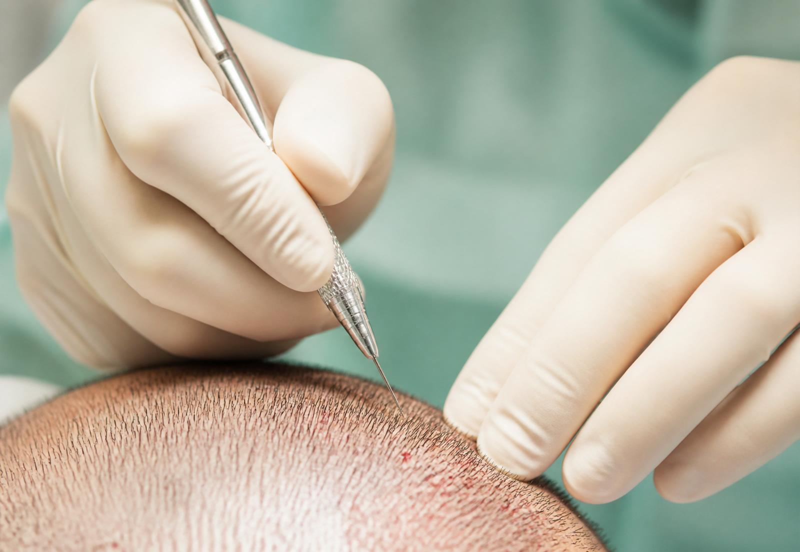 Le diagnostic capillaire : première étape essentielle